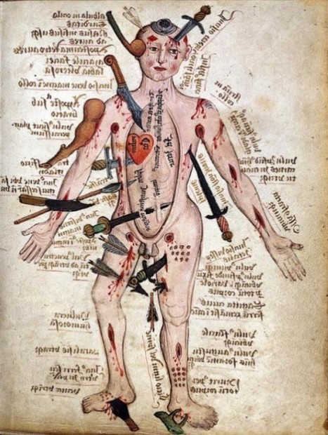 WoundManmedievalworkag1